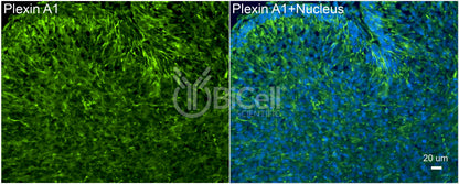 Plexin A1 (PLXNA1) Antibody
