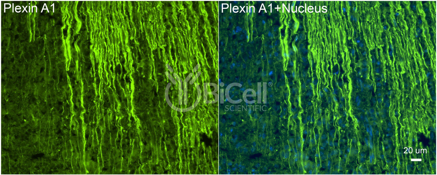 Plexin A1 (PLXNA1) Antibody - Western Blot Validated