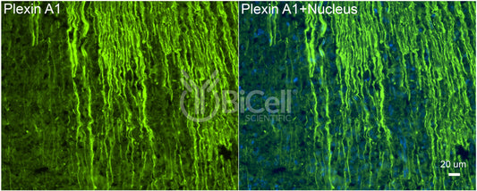Plexin A1 (PLXNA1) Antibody - Western Blot Validated