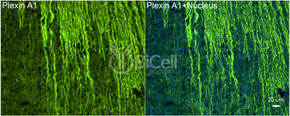 Plexin A1 (PLXNA1) Antibody