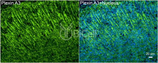 Plexin A3 (PLXNA3) Antibody - Western Blot Validated