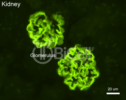 Podocin (Nphs2) Antibody - Western Blot Validated