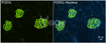 Podocalyxin (PODXL or gp135) Antibody - Western Blot Validated