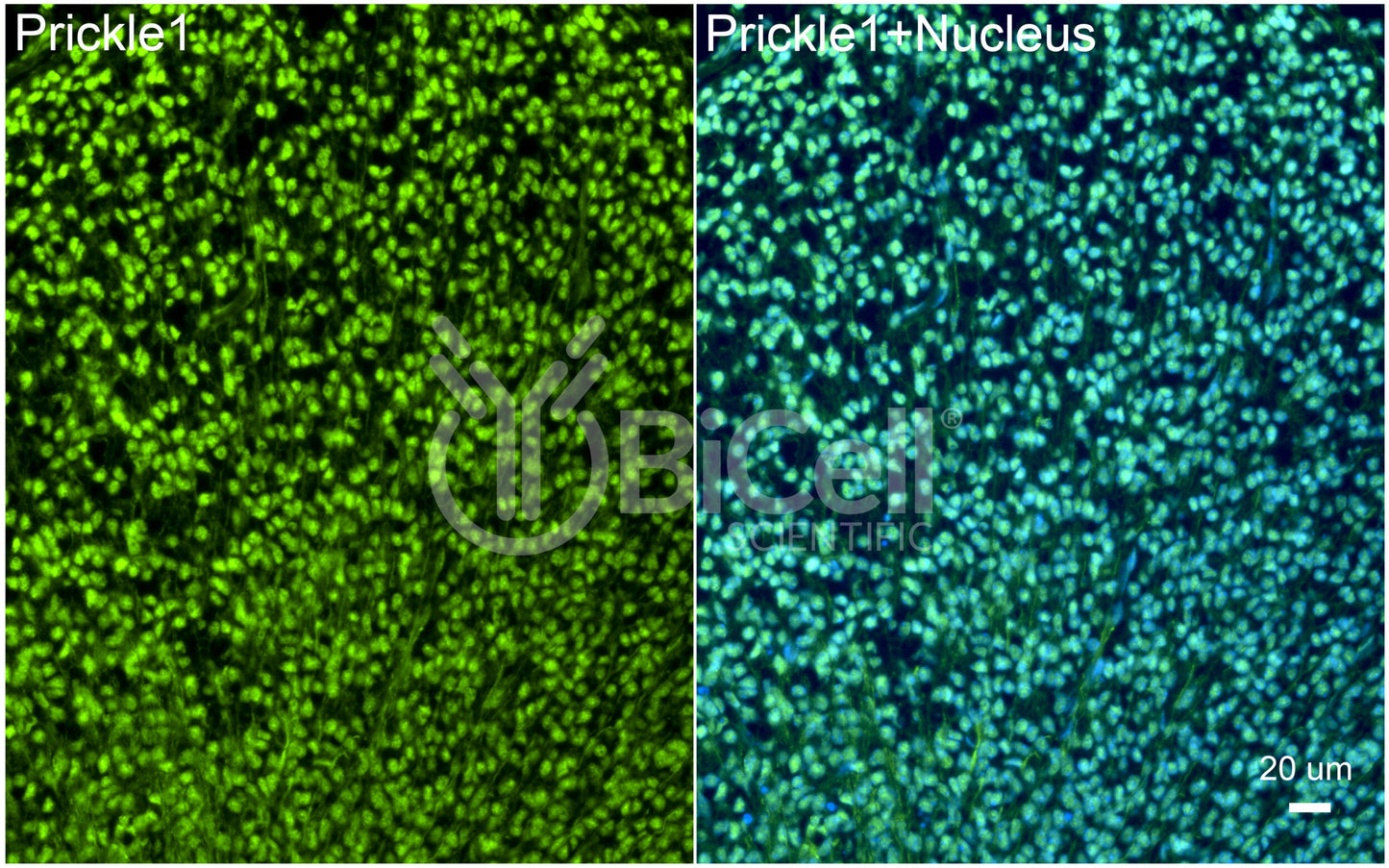 PRICKLE1 (RILP) Antibody - Western Blot Validated