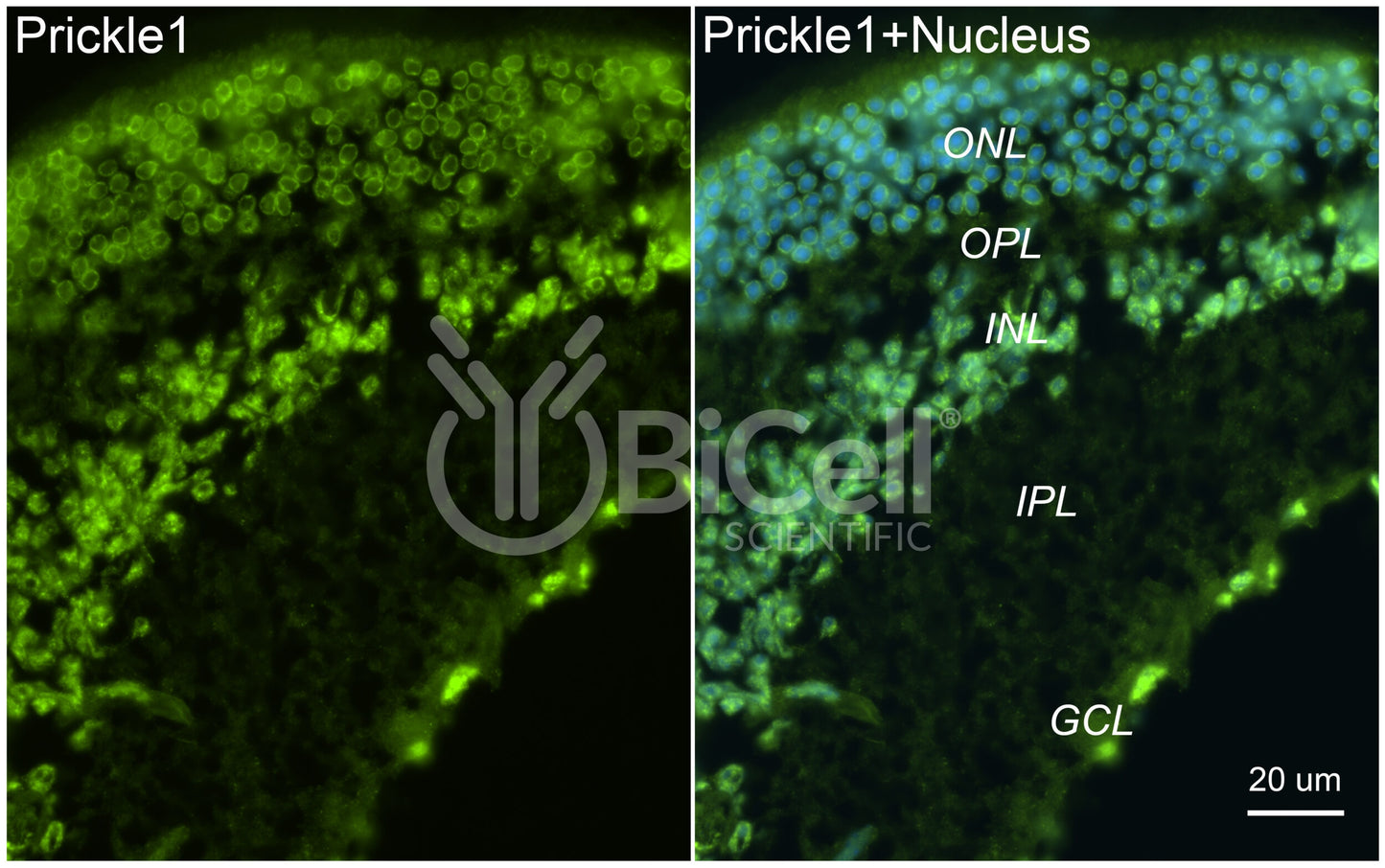 PRICKLE1 (RILP) Antibody - Western Blot Validated