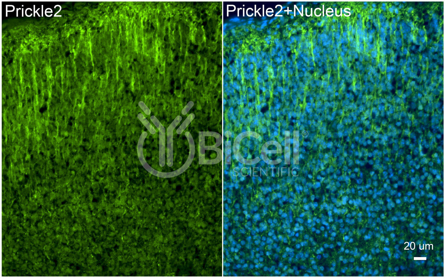PRICKLE2 (EPM5) Antibody - Western Blot Validated