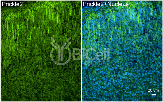 PRICKLE2 (EPM5) Antibody - Western Blot Validated