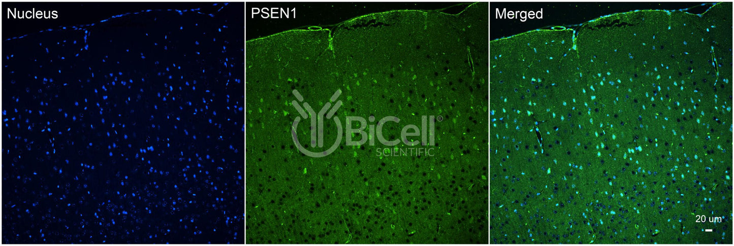 Presenilin-1 (PSEN1 or PS1 or AD3) Antibody
