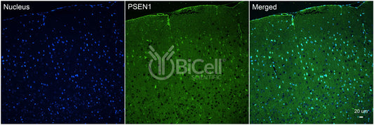 Presenilin-1 (PSEN1 or PS1 or AD3) Antibody
