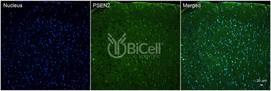 Presenilin-2 (PSEN2 or PS2 or AD4) Antibody - Western Blot Validated