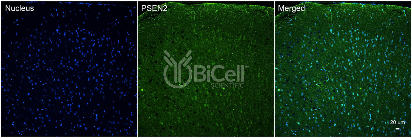 Presenilin-2 (PSEN2 or PS2 or AD4) Antibody