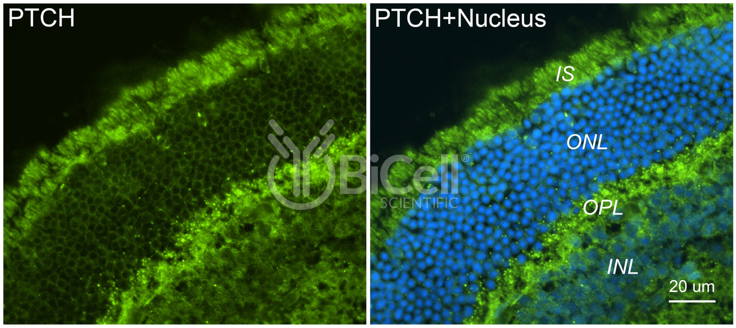 Patched-1 (PTCH1 or PTCH) Antibody - Western Blot Validated