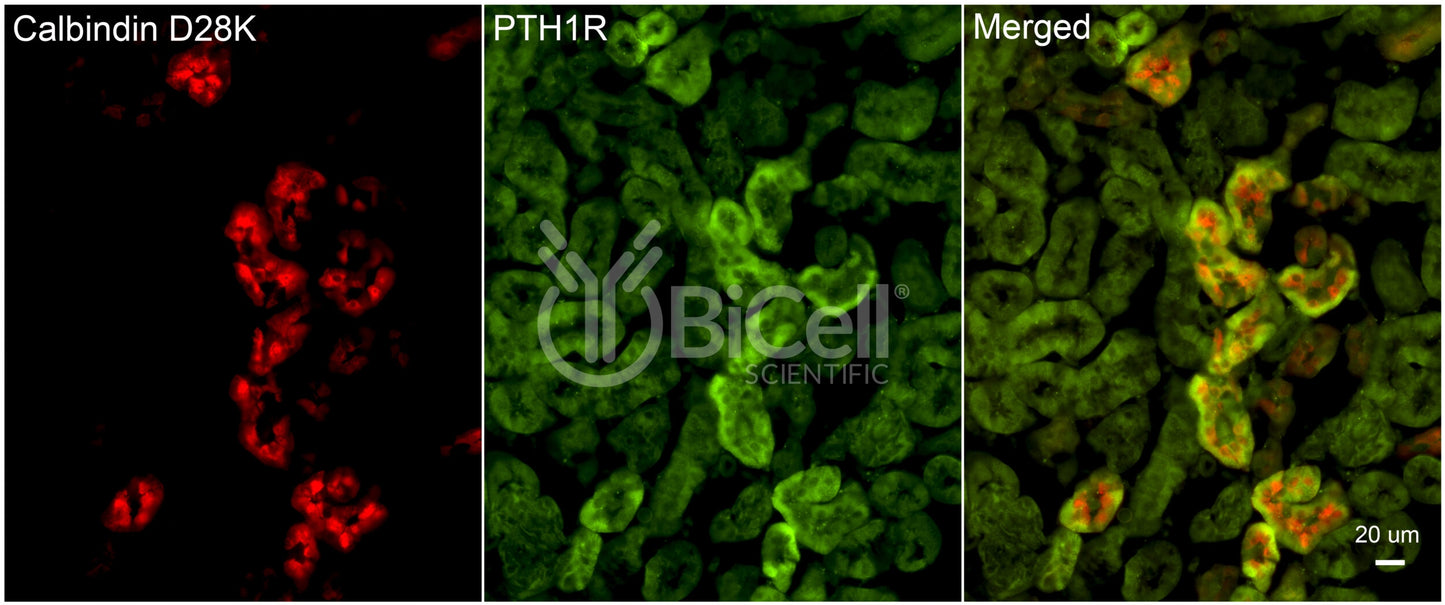 PTH1R Antibody