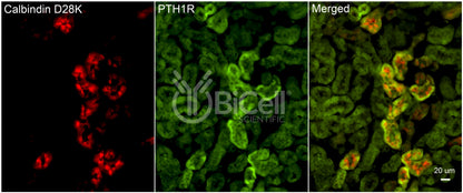 PTH1R Antibody - FFPE Validated