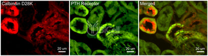 PTH1R Antibody