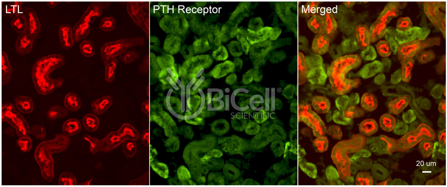 PTH1R Antibody - Western Blot Validated