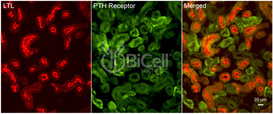 PTH1R Antibody - Western Blot Validated