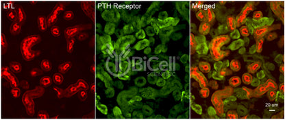 PTH1R Antibody - FFPE Validated
