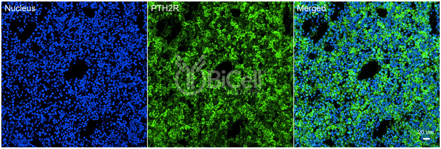 PTH2R Antibody