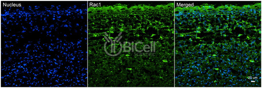 RAC1 Antibody - Western Blot Validated
