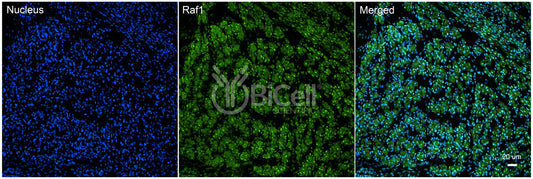 RAF1 (c-Raf or CRAF) Antibody - FFPE Validated