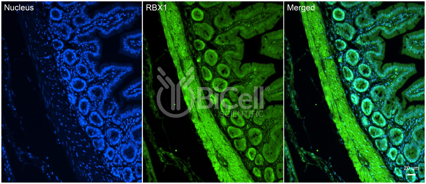 RBX1 (ROC1) Antibody - Western Blot Validated