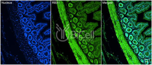 RBX1 (ROC1) Antibody - Western Blot Validated