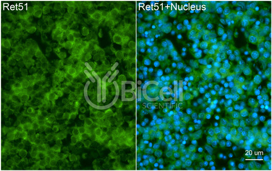 RET51 (RET or CDHF12 or CDHR16) Antibody - Western Blot Validated