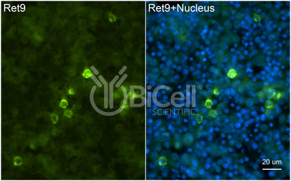 RET9 (RET or CDHF12 or CDHR16) Antibody - Western Blot Validated