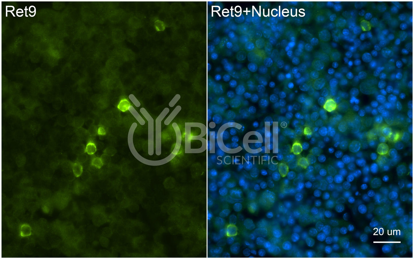 RET9 (RET or CDHF12 or CDHR16) Antibody