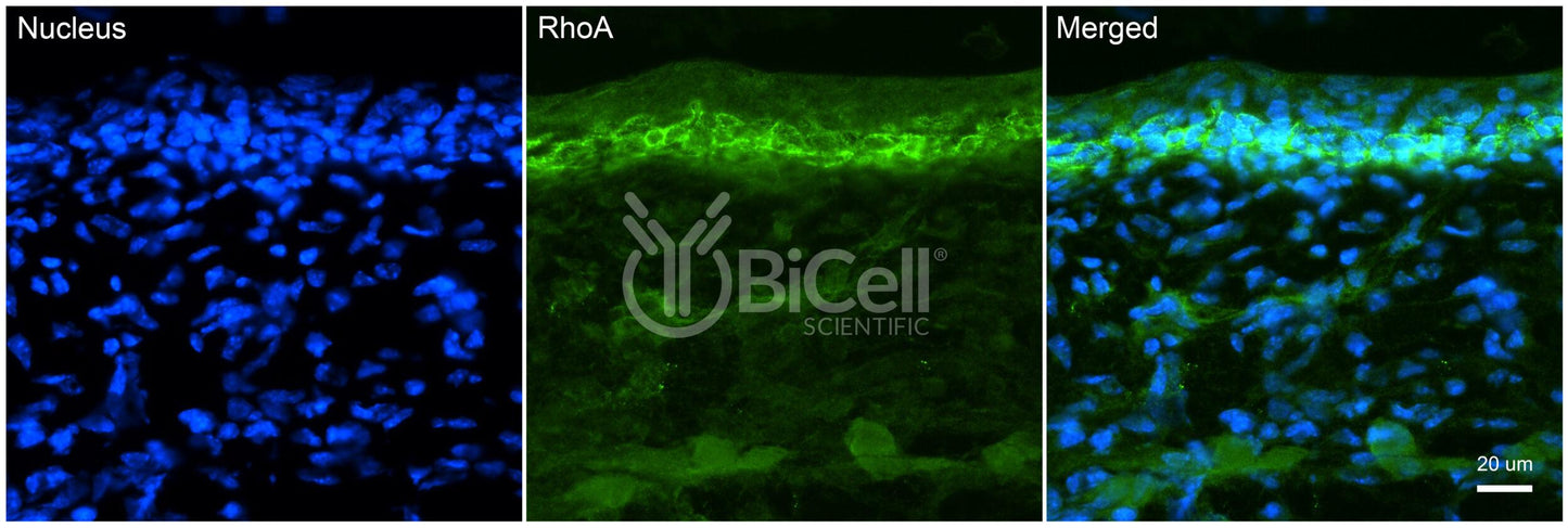 RhoA Antibody - FFPE Validated