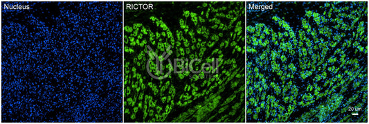 RICTOR Antibody - FFPE Validated