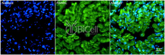 TNFSF11 (RANKL or CD254) Antibody - FFPE Validated