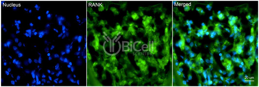 TNFRSF11A (RANK or CD265) Antibody - Western Blot Validated