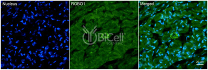 ROBO1 Antibody
