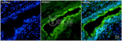 ROBO1 Antibody