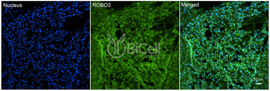 ROBO3 Antibody - Western Blot Validated
