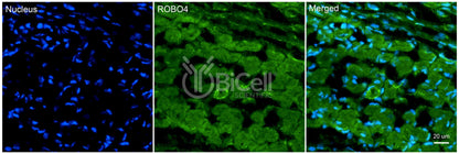 ROBO4 Antibody - FFPE Validated