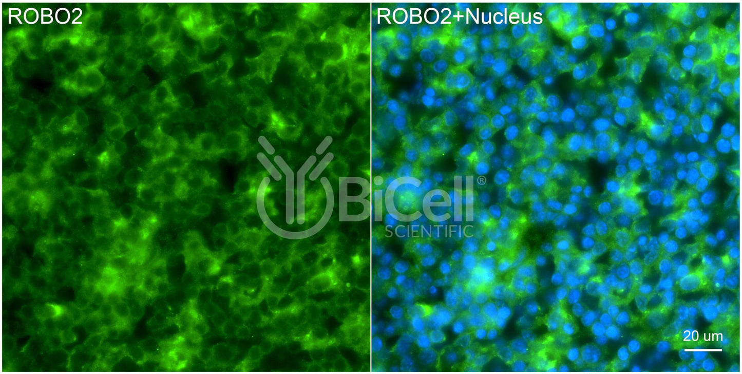 ROBO2 Antibody - Western Blot Validated