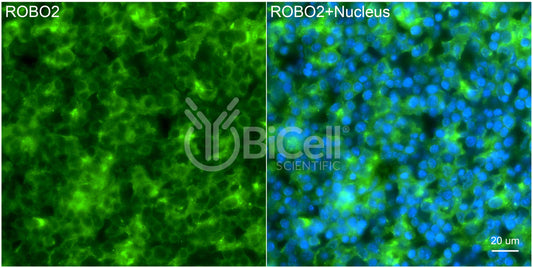 ROBO2 Antibody - Western Blot Validated