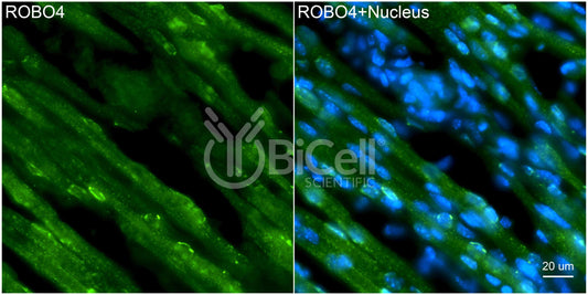 ROBO4 Antibody - Western Blot Validated