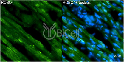 ROBO4 Antibody