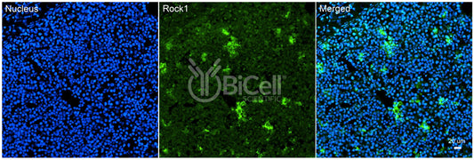 ROCK1 Antibody