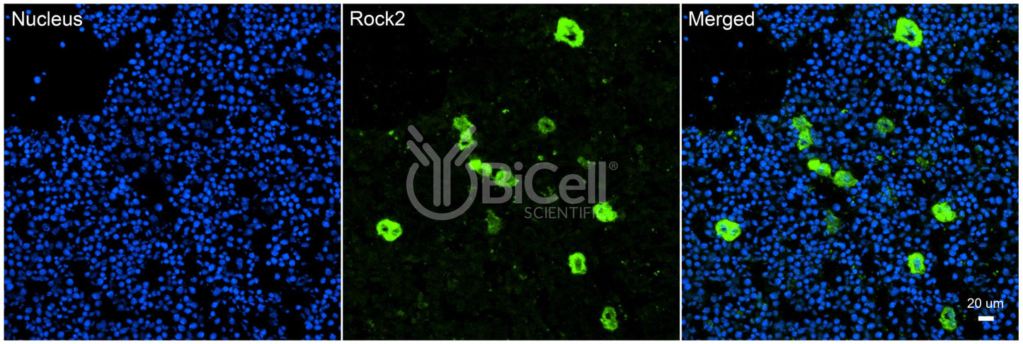 ROCK2 Antibody - Western Blot Validated