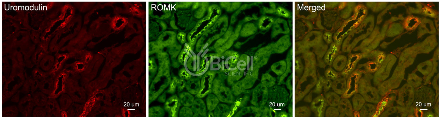 ROMK (Kir1.1 or KCNJ1) Antibody - Western Blot Validated
