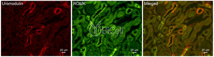 ROMK (Kir1.1 or KCNJ1) Antibody