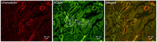 ROMK (Kir1.1 or KCNJ1) Antibody - FFPE Validated