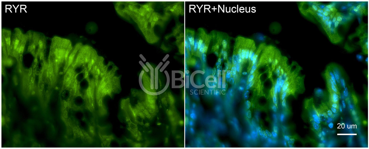 RYR1 (RYR) Antibody - FFPE Validated