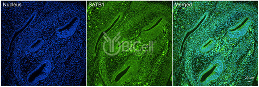 SATB1 Antibody - Western Blot Validated