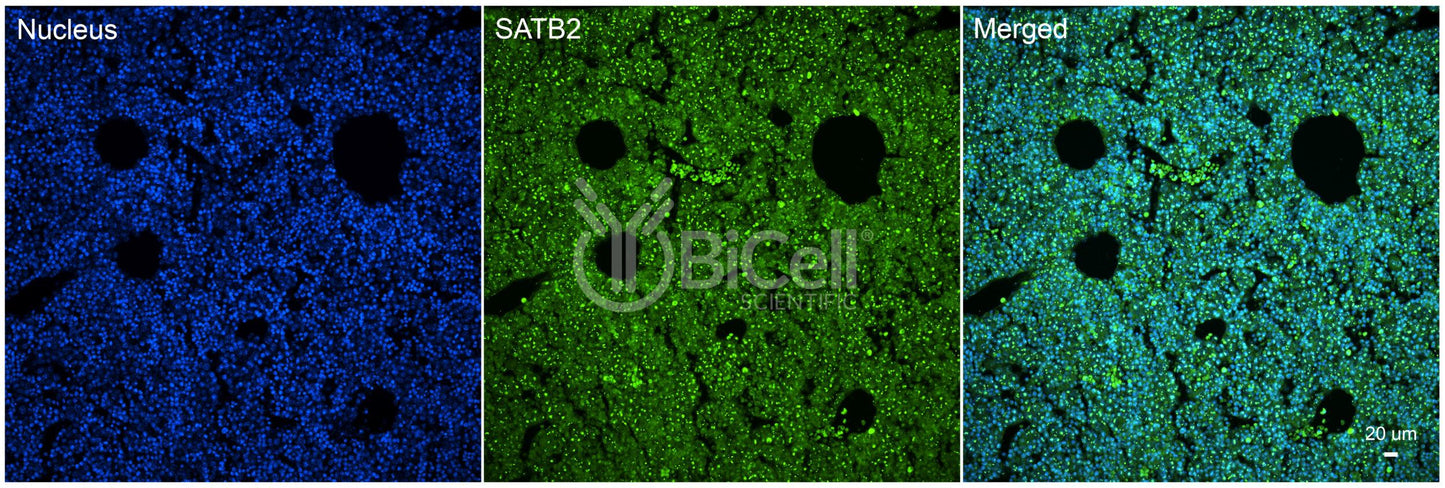SATB2 Antibody - FFPE Validated